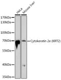 Western blot analysis of extracts of various cell lines, using Cytokeratin 2e  antibody  at 1:1000 dilution.
Secondary antibody: HRP Goat Anti-Rabbit IgG   at 1:10000 dilution.
Lysates/proteins: 25ug per lane.
Blocking buffer: 3% nonfat dry milk in TBST.
Detection: ECL Basic Kit .
Exposure time: 90s.