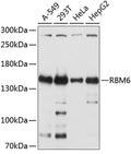 Western blot analysis of extracts of various cell lines, using RBM6 antibody  at 1:2000 dilution.
Secondary antibody: HRP Goat Anti-Rabbit IgG   at 1:10000 dilution.
Lysates/proteins: 25ug per lane.
Blocking buffer: 3% nonfat dry milk in TBST.
Detection: ECL Basic Kit .
Exposure time: 5s.