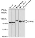 Western blot analysis of extracts of various cell lines, using GPSM2 antibody  at 1:1000 dilution.
Secondary antibody: HRP Goat Anti-Rabbit IgG   at 1:10000 dilution.
Lysates/proteins: 25ug per lane.
Blocking buffer: 3% nonfat dry milk in TBST.
Detection: ECL Basic Kit .
Exposure time: 10s.