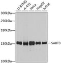 Western blot analysis of extracts of various cell lines, using SART3 antibody  at 1:3000 dilution.
Secondary antibody: HRP Goat Anti-Rabbit IgG   at 1:10000 dilution.
Lysates/proteins: 25ug per lane.
Blocking buffer: 3% nonfat dry milk in TBST.
Detection: ECL Basic Kit .
Exposure time: 30s.