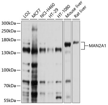 Western blot analysis of extracts of various cell lines, using MAN2A1 antibody  at 1:1000 dilution.
Secondary antibody: HRP Goat Anti-Rabbit IgG   at 1:10000 dilution.
Lysates/proteins: 25ug per lane.
Blocking buffer: 3% nonfat dry milk in TBST.
Detection: ECL Basic Kit .
Exposure time: 1s.
