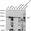 Western blot analysis of extracts of various cell lines, using PLB1 antibody  at 1:1000 dilution.
Secondary antibody: HRP Goat Anti-Rabbit IgG   at 1:10000 dilution.
Lysates/proteins: 25ug per lane.
Blocking buffer: 3% nonfat dry milk in TBST.
Detection: ECL Basic Kit .
Exposure time: 5s.