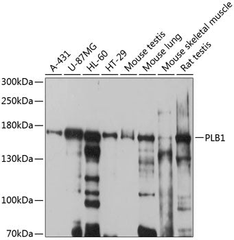 Western blot analysis of extracts of various cell lines, using PLB1 antibody  at 1:1000 dilution.
Secondary antibody: HRP Goat Anti-Rabbit IgG   at 1:10000 dilution.
Lysates/proteins: 25ug per lane.
Blocking buffer: 3% nonfat dry milk in TBST.
Detection: ECL Basic Kit .
Exposure time: 5s.