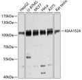Western blot analysis of extracts of various cell lines, using KIAA1524 antibody  at 1:3000 dilution.
Secondary antibody: HRP Goat Anti-Rabbit IgG   at 1:10000 dilution.
Lysates/proteins: 25ug per lane.
Blocking buffer: 3% nonfat dry milk in TBST.
Detection: ECL Basic Kit .
Exposure time: 10s.