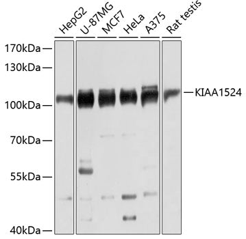 Western blot analysis of extracts of various cell lines, using KIAA1524 antibody  at 1:3000 dilution.
Secondary antibody: HRP Goat Anti-Rabbit IgG   at 1:10000 dilution.
Lysates/proteins: 25ug per lane.
Blocking buffer: 3% nonfat dry milk in TBST.
Detection: ECL Basic Kit .
Exposure time: 10s.