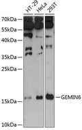 Western blot analysis of extracts of various cell lines, using GEMIN6 antibody.