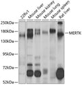 Western blot analysis of extracts of Mouse spleen, using MERTK antibody  at 1:1000 dilution.
Secondary antibody: HRP Goat Anti-Rabbit IgG   at 1:10000 dilution.
Lysates/proteins: 25ug per lane.
Blocking buffer: 3% nonfat dry milk in TBST.
Detection: ECL Enhanced Kit .
Exposure time: 180s.