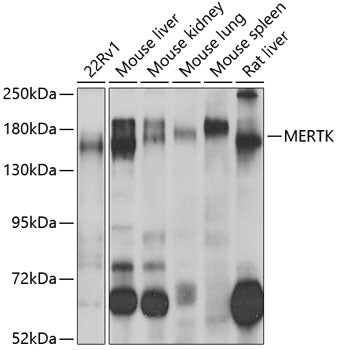 Western blot analysis of extracts of Mouse spleen, using MERTK antibody  at 1:1000 dilution.
Secondary antibody: HRP Goat Anti-Rabbit IgG   at 1:10000 dilution.
Lysates/proteins: 25ug per lane.
Blocking buffer: 3% nonfat dry milk in TBST.
Detection: ECL Enhanced Kit .
Exposure time: 180s.