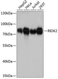 Western blot analysis of extracts of various cell lines, using RIOK2 antibody  at 1:3000 dilution.
Secondary antibody: HRP Goat Anti-Rabbit IgG   at 1:10000 dilution.
Lysates/proteins: 25ug per lane.
Blocking buffer: 3% nonfat dry milk in TBST.
Detection: ECL Basic Kit .
Exposure time: 90s.