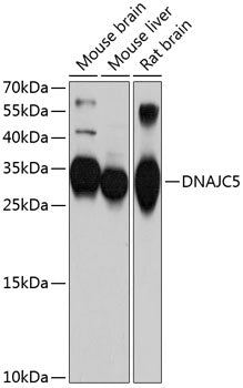 Western blot analysis of extracts of various cell lines, using DNAJC5 antibody  at 1:1000 dilution.
Secondary antibody: HRP Goat Anti-Rabbit IgG   at 1:10000 dilution.
Lysates/proteins: 25ug per lane.
Blocking buffer: 3% nonfat dry milk in TBST.
Detection: ECL Basic Kit .
Exposure time: 90s.
