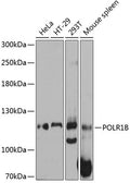 Western blot analysis of extracts of various cell lines, using POLR1B antibody  at 1:3000 dilution.
Secondary antibody: HRP Goat Anti-Rabbit IgG   at 1:10000 dilution.
Lysates/proteins: 25ug per lane.
Blocking buffer: 3% nonfat dry milk in TBST.
Detection: ECL Basic Kit .
Exposure time: 10s.