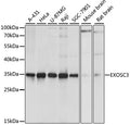 Western blot analysis of extracts of various cell lines, using EXOSC3 antibody  at 1:1000 dilution.
Secondary antibody: HRP Goat Anti-Rabbit IgG   at 1:10000 dilution.
Lysates/proteins: 25ug per lane.
Blocking buffer: 3% nonfat dry milk in TBST.
Detection: ECL Basic Kit .
Exposure time: 1s.
