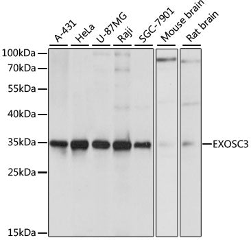 Western blot analysis of extracts of various cell lines, using EXOSC3 antibody  at 1:1000 dilution.
Secondary antibody: HRP Goat Anti-Rabbit IgG   at 1:10000 dilution.
Lysates/proteins: 25ug per lane.
Blocking buffer: 3% nonfat dry milk in TBST.
Detection: ECL Basic Kit .
Exposure time: 1s.