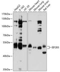 Western blot analysis of extracts of various cell lines, using EIF2B3 antibody  at 1:1000 dilution.
Secondary antibody: HRP Goat Anti-Rabbit IgG   at 1:10000 dilution.
Lysates/proteins: 25ug per lane.
Blocking buffer: 3% nonfat dry milk in TBST.
Detection: ECL Basic Kit .
Exposure time: 10s.
