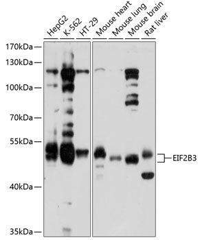 Western blot analysis of extracts of various cell lines, using EIF2B3 antibody  at 1:1000 dilution.
Secondary antibody: HRP Goat Anti-Rabbit IgG   at 1:10000 dilution.
Lysates/proteins: 25ug per lane.
Blocking buffer: 3% nonfat dry milk in TBST.
Detection: ECL Basic Kit .
Exposure time: 10s.