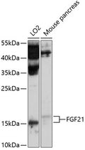 Western blot analysis of extracts of various cell lines, using FGF21 antibody  at 1:1000 dilution.
Secondary antibody: HRP Goat Anti-Rabbit IgG   at 1:10000 dilution.
Lysates/proteins: 25ug per lane.
Blocking buffer: 3% nonfat dry milk in TBST.
Detection: ECL Basic Kit .
Exposure time: 90s.