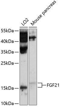 Western blot analysis of extracts of various cell lines, using FGF21 antibody  at 1:1000 dilution.
Secondary antibody: HRP Goat Anti-Rabbit IgG   at 1:10000 dilution.
Lysates/proteins: 25ug per lane.
Blocking buffer: 3% nonfat dry milk in TBST.
Detection: ECL Basic Kit .
Exposure time: 90s.
