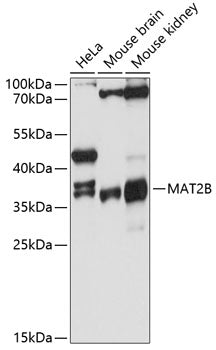 Western blot analysis of extracts of various cell lines, using MAT2B antibody  at 1:3000 dilution.
Secondary antibody: HRP Goat Anti-Rabbit IgG   at 1:10000 dilution.
Lysates/proteins: 25ug per lane.
Blocking buffer: 3% nonfat dry milk in TBST.
Detection: ECL Basic Kit .
Exposure time: 30s.
