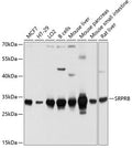 Western blot analysis of extracts of various cell lines, using SRPRB antibody  at 1:1000 dilution.
Secondary antibody: HRP Goat Anti-Rabbit IgG   at 1:10000 dilution.
Lysates/proteins: 25ug per lane.
Blocking buffer: 3% nonfat dry milk in TBST.
Detection: ECL Basic Kit .
Exposure time: 5s.
