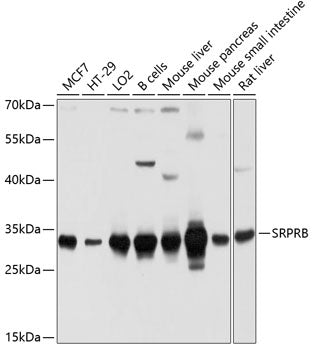 Western blot analysis of extracts of various cell lines, using SRPRB antibody  at 1:1000 dilution.
Secondary antibody: HRP Goat Anti-Rabbit IgG   at 1:10000 dilution.
Lysates/proteins: 25ug per lane.
Blocking buffer: 3% nonfat dry milk in TBST.
Detection: ECL Basic Kit .
Exposure time: 5s.