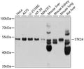 Western blot analysis of extracts of various cell lines, using STK24 antibody  at 1:1000 dilution.
Secondary antibody: HRP Goat Anti-Rabbit IgG   at 1:10000 dilution.
Lysates/proteins: 25ug per lane.
Blocking buffer: 3% nonfat dry milk in TBST.
Detection: ECL Basic Kit .
Exposure time: 1s.