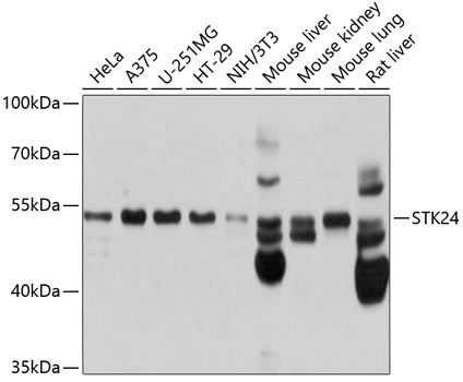 Western blot analysis of extracts of various cell lines, using STK24 antibody  at 1:1000 dilution.
Secondary antibody: HRP Goat Anti-Rabbit IgG   at 1:10000 dilution.
Lysates/proteins: 25ug per lane.
Blocking buffer: 3% nonfat dry milk in TBST.
Detection: ECL Basic Kit .
Exposure time: 1s.