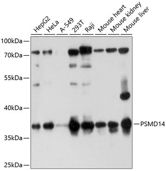 Western blot analysis of extracts of various cell lines, using PSMD14 antibody  at 1:1000 dilution.
Secondary antibody: HRP Goat Anti-Rabbit IgG   at 1:10000 dilution.
Lysates/proteins: 25ug per lane.
Blocking buffer: 3% nonfat dry milk in TBST.
Detection: ECL Basic Kit .
Exposure time: 30s.