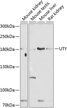 UTY polyclonal antibody – Figure 1 of 1