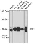 Western blot analysis of extracts of various cell lines, using XPOT antibody  at 1:3000 dilution.
Secondary antibody: HRP Goat Anti-Rabbit IgG   at 1:10000 dilution.
Lysates/proteins: 25ug per lane.
Blocking buffer: 3% nonfat dry milk in TBST.
Detection: ECL Basic Kit .
Exposure time: 10s.