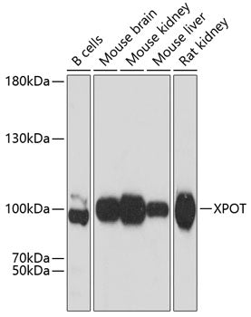 Western blot analysis of extracts of various cell lines, using XPOT antibody  at 1:3000 dilution.
Secondary antibody: HRP Goat Anti-Rabbit IgG   at 1:10000 dilution.
Lysates/proteins: 25ug per lane.
Blocking buffer: 3% nonfat dry milk in TBST.
Detection: ECL Basic Kit .
Exposure time: 10s.