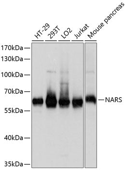Western blot analysis of extracts of various cell lines, using NARS antibody  at 1:1000 dilution.
Secondary antibody: HRP Goat Anti-Rabbit IgG   at 1:10000 dilution.
Lysates/proteins: 25ug per lane.
Blocking buffer: 3% nonfat dry milk in TBST.
Detection: ECL Basic Kit .
Exposure time: 3s.