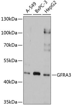 Western blot analysis of extracts of various cell lines, using GFRA3 antibody  at 1:1000 dilution.
Secondary antibody: HRP Goat Anti-Rabbit IgG   at 1:10000 dilution.
Lysates/proteins: 25ug per lane.
Blocking buffer: 3% nonfat dry milk in TBST.
Detection: ECL Basic Kit .
Exposure time: 10s.