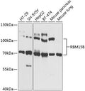 RBM15B polyclonal antibody – Figure 1 of 1