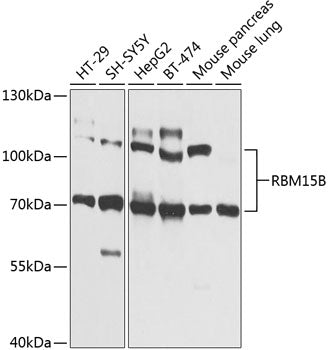 RBM15B polyclonal antibody – Figure 1 of 1