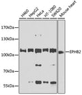 EPHB2 polyclonal antibody – Figure 1 of 1