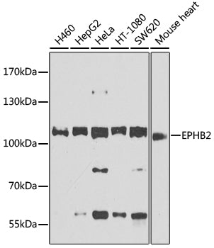 EPHB2 polyclonal antibody – Figure 1 of 1