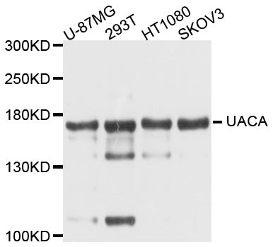 Western blot analysis of extracts of various cell lines, using UACA antibody at 1:1000 dilution.