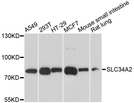SLC34A2 polyclonal antibody – Figure 1 of 1