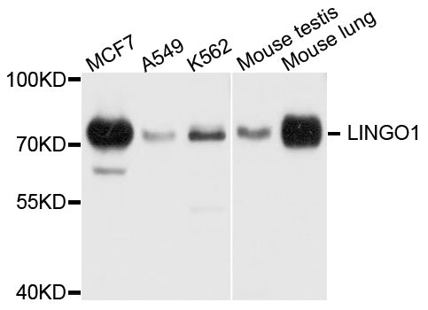 Western blot analysis of extracts of various cell lines, using LINGO1 antibody at 1:1000 dilution.