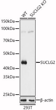[KO Validated] SUCLG2 polyclonal antibody – Figure 1 of 5