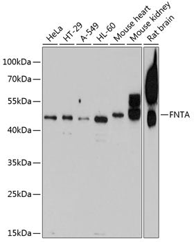 FNTA polyclonal antibody – Figure 1 of 1
