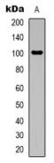 Western blot analysis of Aconitase 1 expression in Hela (A) whole cell lysates.