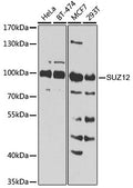 [KO Validated] SUZ12 polyclonal antibody – Figure 1 of 5