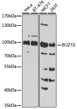 [KO Validated] SUZ12 polyclonal antibody – Figure 1 of 5