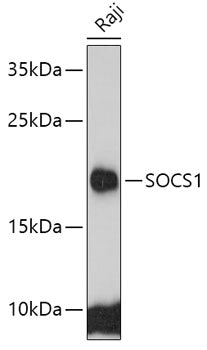SOCS1 polyclonal antibody – Figure 1 of 1