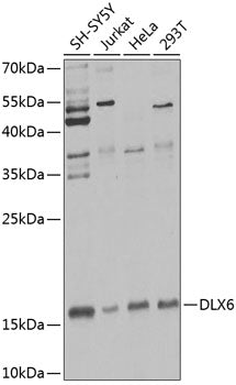 Western blot analysis of extracts of various cell lines, using DLX6 Antibody  at 1:1000 dilution.
Secondary antibody: HRP Goat Anti-Rabbit IgG   at 1:10000 dilution.
Lysates/proteins: 25ug per lane.
Blocking buffer: 3% nonfat dry milk in TBST.
Detection: ECL Enhanced Kit .
Exposure time: 60s.