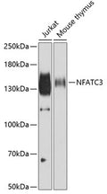 Western blot analysis of extracts of various cell lines, using NFATC3 antibody  at 1:500 dilution.
Secondary antibody: HRP…