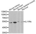 Western blot analysis of extracts of various cell lines, using IL11RA Antibody at 1:1000 dilution.