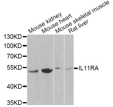 Western blot analysis of extracts of various cell lines, using IL11RA Antibody at 1:1000 dilution.