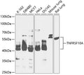 Western blot analysis of extracts of various cell lines, using TNFRSF10A antibody  at 1:1000 dilution.
Secondary antibody: HRP Goat Anti-Rabbit IgG   at 1:10000 dilution.
Lysates/proteins: 25ug per lane.
Blocking buffer: 3% nonfat dry milk in TBST.
Detection: ECL Basic Kit .
Exposure time: 60s.